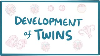 Development of twins [upl. by Catt]