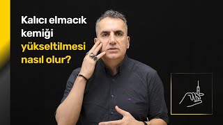 Elmacık kemiği kalıcı olarak yükseltilebilir mi  Op Dr Orhan Murat Özdemir [upl. by Bang568]