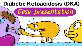 Diabetic Ketoacidosis case presentation [upl. by Attennod]