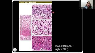 Histology of the Adrenal Suprarenal Glands [upl. by Sage]