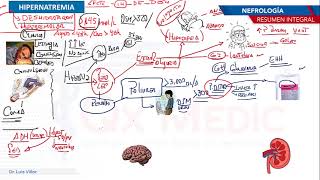 Nefrología  Hipernatremia [upl. by Bethel]