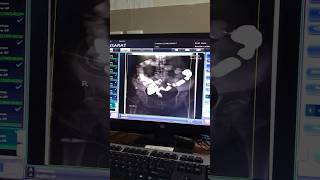 X ray  fluoroscopy procedure  fluoroscopy trending viral shorts arabic [upl. by Brock975]