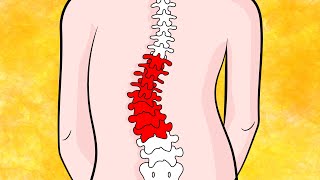 How to Fix Lumbar Scoliosis in 4 minutes naturally [upl. by Gersham]