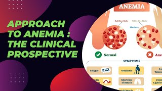 Approach to Anemia  The clinical Prospective [upl. by Lori]