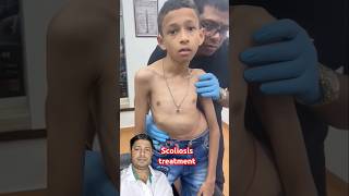 Scoliosis treatment chiropractic scoliosistreatment chiropractic funny chiropratic doctor [upl. by Puri]