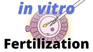 In Vitro Fertilization IVF explained [upl. by Keeton]