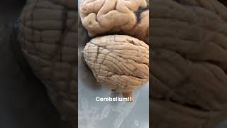 cerebellum anatomy bertukarsementarabermaknaselamanya [upl. by Bernj]