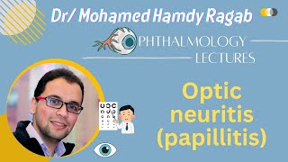 Neuro 2 Optic neuritis papillitis [upl. by Enowtna621]