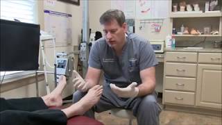 Treating Toenail Fungus with Lamisil [upl. by Godewyn]