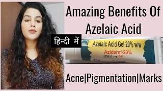 Azelaic Acid  Benefits amp Side effects AzelaicAcid aziderm pigmentation hyperpigmentation acne [upl. by Tihw304]