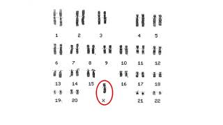 Chromosome Analysis [upl. by Childers155]