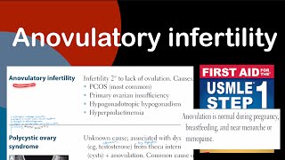 Anovulatory infertility in HindiUrdu by first aid for USMLE step 1 [upl. by Lien]