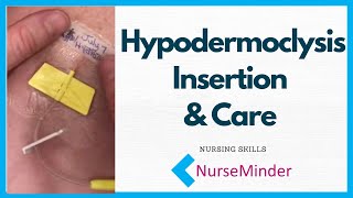 Hypodermoclysis Insertion and Care for Nurses [upl. by Ivanna745]