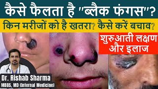 Black Fungus Mucormycosis Symptoms Preventive Tips Treatment in Hindi I Post COVID Mucormycosis [upl. by Gessner]