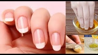 ASTUCE FAIRE POUSSER SES ONGLES PLUS VITE [upl. by Bronson]