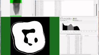 Bruker microCT tutorial Analysis of the tooth part 2 enamel and dentine [upl. by Eaner]