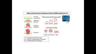 AdenomKarzinomSequenz beim Rektumkarzinom  Strahlentherapie Prof Hilke Vorwerk [upl. by Dora]