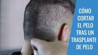 CORTE DE PELO TRAS UN TRASPLANTE DE PELO Pautas para el corte de pelo [upl. by Innavoeg349]