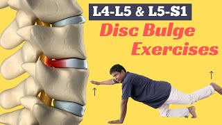 6 Best Diffuse Disc Bulge at L4L5 and L5S1 Treatment Exercises [upl. by Lemhaj]