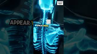 What Is an X Ray Machine  Intro to Biomedical Instrumentation Medical Imaging Device BioMedEng [upl. by Loux]