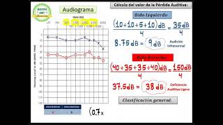 AUDIOGRAMA Y CÁLCULO DE PÉRDIDA AUDITIVA [upl. by Esoranna]