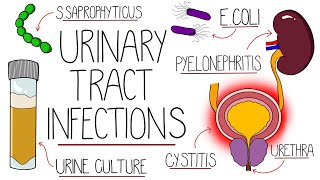 UTI Made Easy  Urinary Tract Infections Explained Clearly [upl. by Tebazile174]