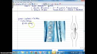 Ch 2K Tensile Strength Cavitation and Embolism [upl. by Kynan]