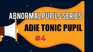 ADIE TONIC PUPIL  DIAGNOSIS AND TREATMENT OF ADIE TONIC PUPIL  Abnormal pupil series  4 [upl. by Reiche]