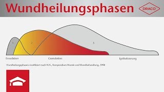 Wundheilungsphasen im Überblick  Exsudationsphase Granulationsphase Epithelisierungsphase [upl. by Alenairam937]