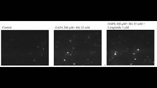 Exosome nanoparticle tracking NTA [upl. by Balsam973]