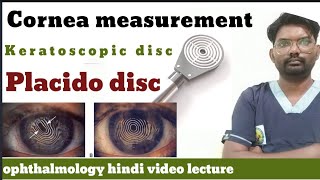 placido disc  keratoscopic disc  use of palcido disk in eye  placidodisc  ophthalmologyhindi [upl. by Belldas212]