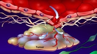 Introduction to Cancer Biology Part 4 Angiogenesis [upl. by Eberle180]