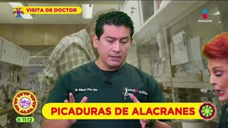 Picadura de alacrán síntomas riesgos y tratamiento  Sale el Sol [upl. by Eihcra673]