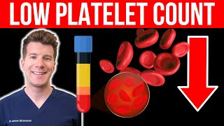 Doctor explains LOW PLATELET COUNT Thrombocytopenia  Causes symptoms and more [upl. by Anawait]