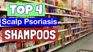 Top 4 Shampoos To Treat Scalp Psoriasis [upl. by Starlin465]