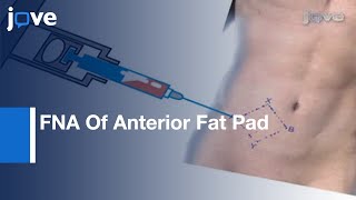 Performing amp Processing FNA Of Anterior Fat Pad For Amyloid l Protocol Preview [upl. by Merry533]