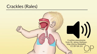 Respiratory Assessment by B Leary L DelSignore  OPENPediatrics [upl. by Frum621]