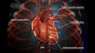 Angioplastia Coronária  Ultrassom  Hospital Cardiológico Costantini [upl. by Etac850]