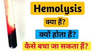 What is hemolysis  Hemolysis in hindi [upl. by Sonny]