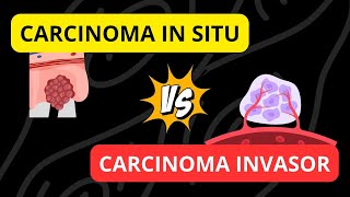 Carcinoma in situ versus Carcinoma invasor [upl. by Horwitz]