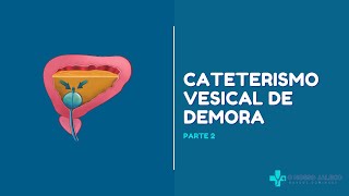 CATETERISMO VESICAL DE DEMORA PARTE 2 [upl. by Aikcin]