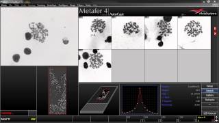 AutoCapt  Automated Image Acquisition with Metafer [upl. by Kantos739]