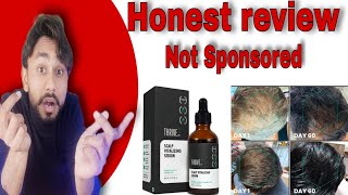 THRIVEco hair serum 20  Honest Review  Use  benefits  side effects [upl. by Gefen]