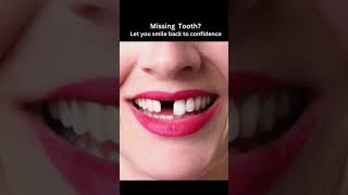 DIY How To Replace Missing Tooth in Less Than 5 Minutes [upl. by Anail]