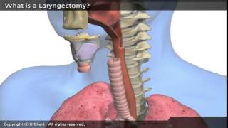 A0001a en A patient´s Guide to Total Laryngectomy Part 1 What is a Laryngectomy [upl. by Atnoed743]