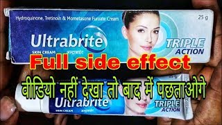 Ultrabrite Cream Side Effect Full Review PharmaMedicine [upl. by Vocaay820]