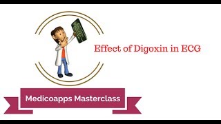 Understanding the Effects on Digoxin on ECG [upl. by Sabra]