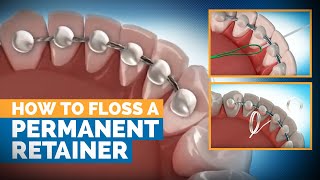 How to Floss a Permanent Retainer  Premier Orthodontics [upl. by Saerdna]