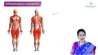 Inflammatory Myopathy  Polymyositis amp Dermatomyositis Hindi   Internal medicine 🩺🩺🩺 [upl. by Amikat]