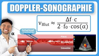 DopplerSonographie Blutfließgeschwindigkeit [upl. by Ttcos]